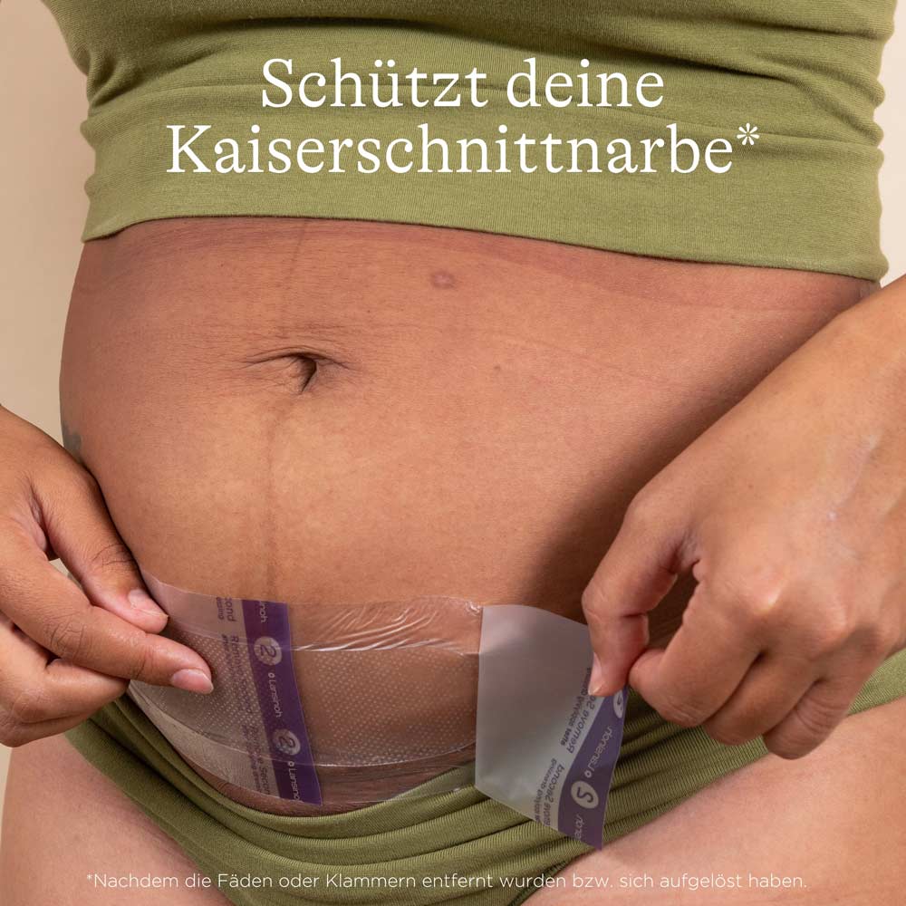lansinoh-kaiserschnitt-hydrogel-pads image 2